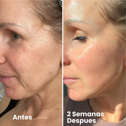 Celimax® Retinal Shot - Adiós Arrugas
